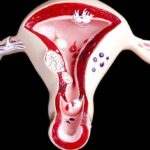 Những điều cần biết về niêm mạc tử cung và khả năng thụ thai