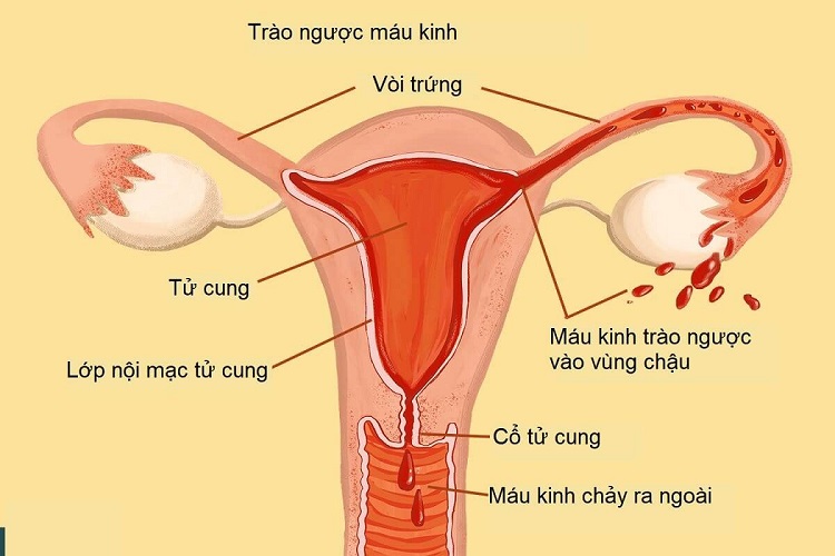 Niêm mạc tử cung là gì?